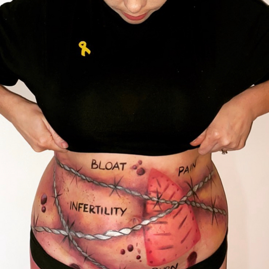 E is for... Endometriosis